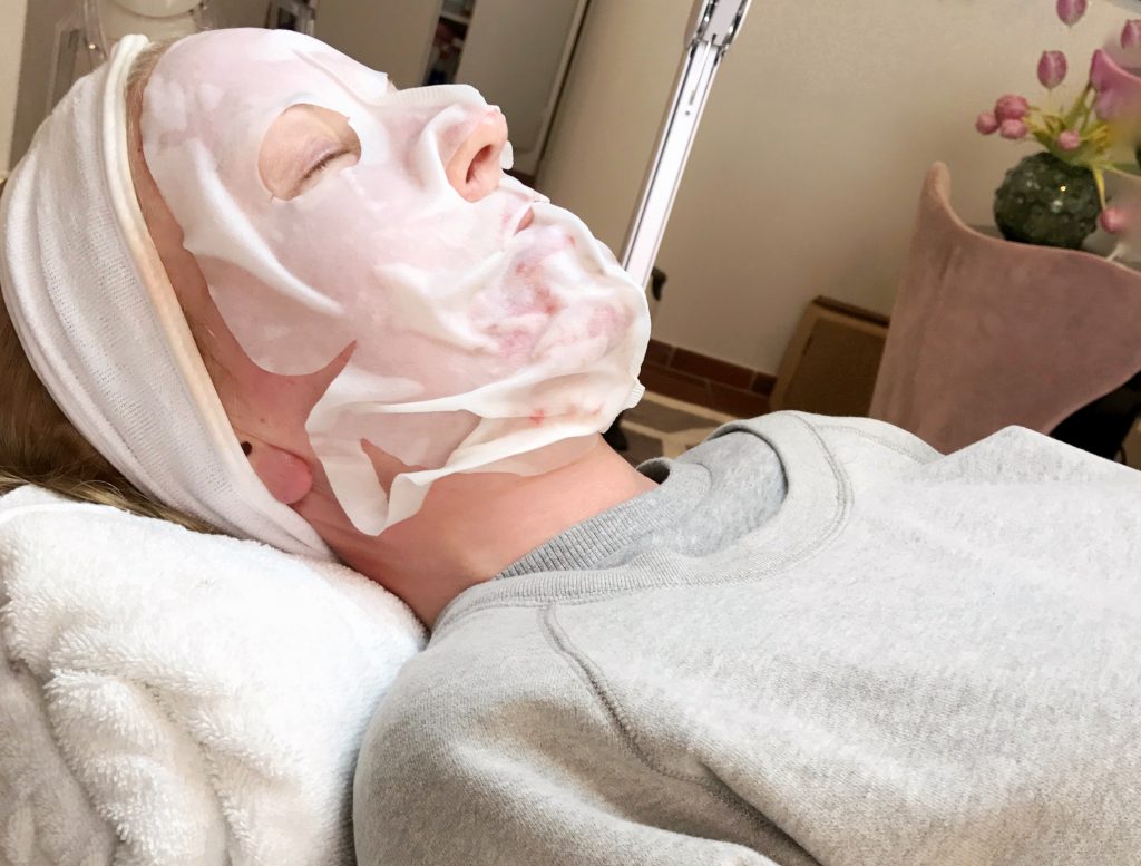 kemisk peeling och dermapen hos bästa stina
